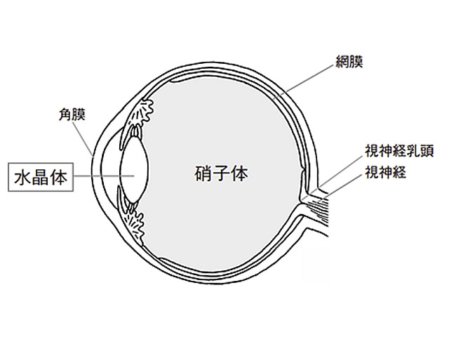 白内障とは